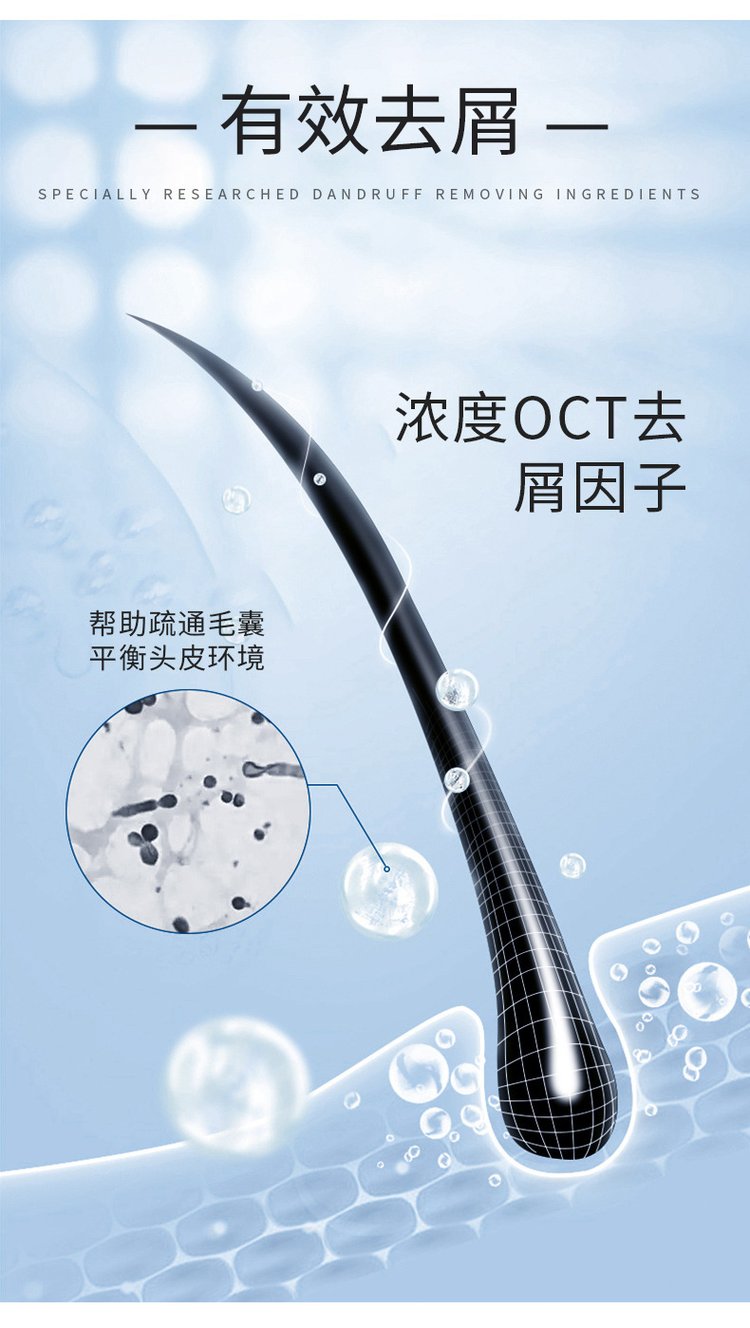 去屑平衡洗發(fā)水有效去屑 去屑平衡洗發(fā)水有效去屑