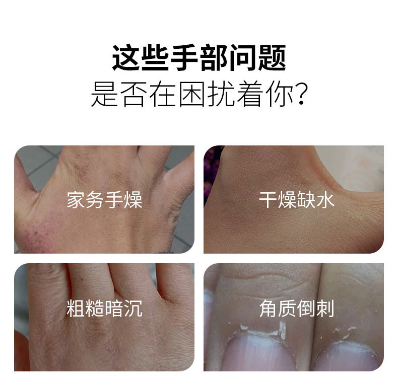 護(hù)手霜幫您解決手部以下問題 護(hù)手霜幫您解決手部以下問題